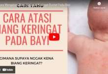 Cara Menghilangkan Biang Keringat Pada Bayi