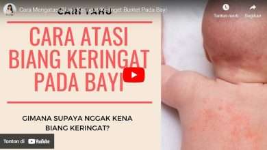 Cara Menghilangkan Biang Keringat Pada Bayi