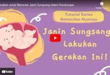 penyebab dan cara mengatasi bayi sungsang