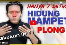 Cara Mengatasi Hidung Mampet
