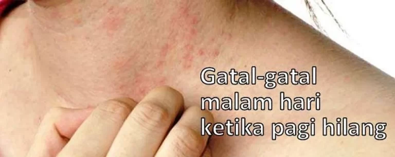 Kapan Harus Mengunjungi Dokter